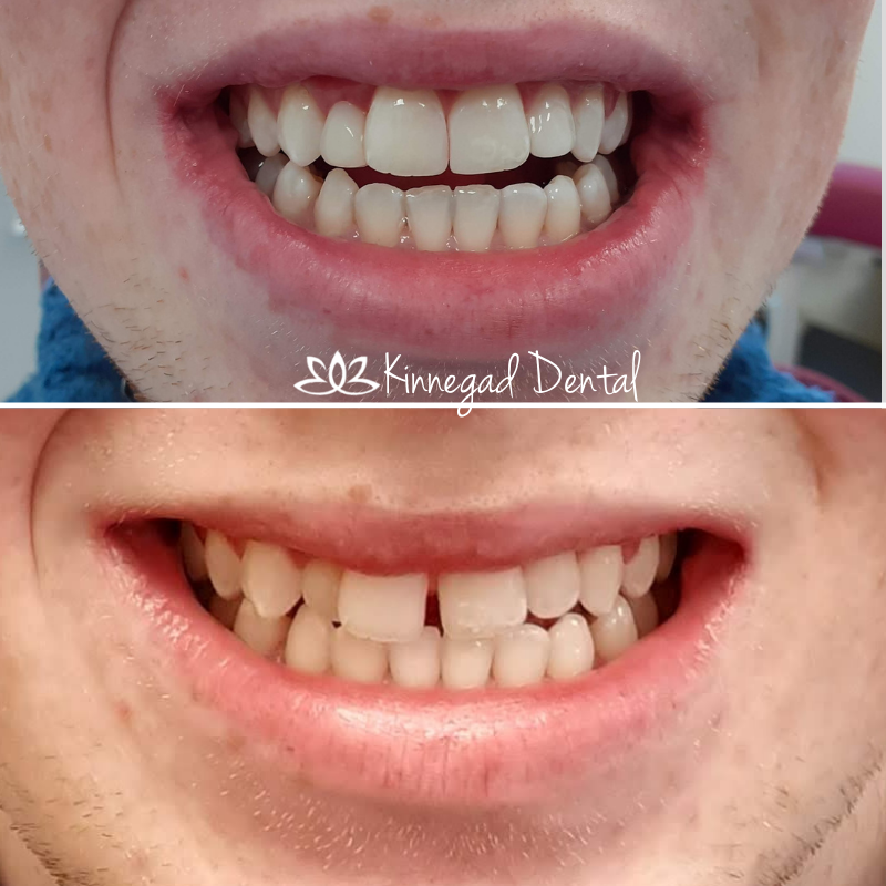 Before & After Image