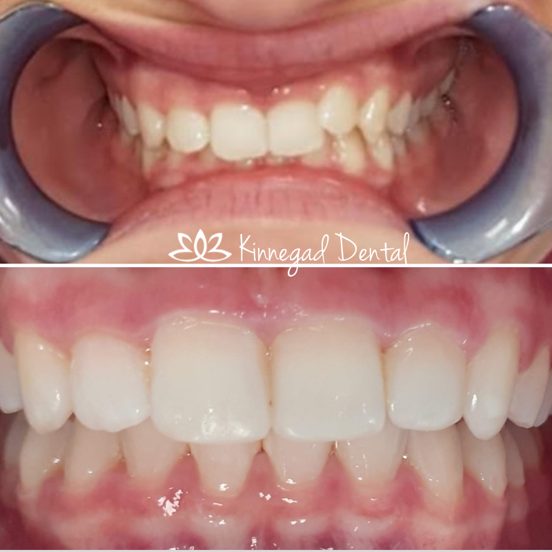 Before & After Image