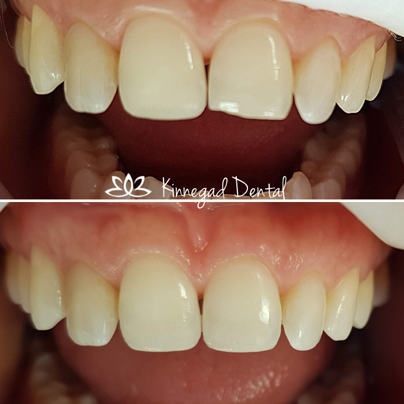 Before & After Image