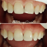 Before & After Image