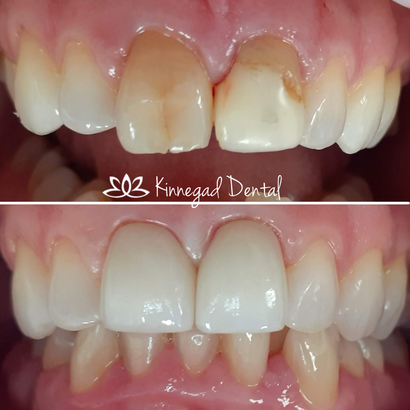Before & After Image